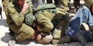 إصابة شاب عقب اعتداء الاحتلال عليه بالضرب شمال القدس