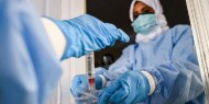 الصحة: 6 وفيات و458 إصابة جديدة بفيروس كورونا