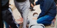 إصابة مواطن برصاص أجهزة أمن السلطة في مخيم عسكر بنابلس