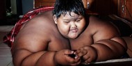أسمن طفل في العالم يخسر 115 كيلو من وزنه