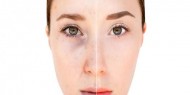 طرق سهلة لعلاج تصبغات الوجه