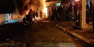 3 إصابات بالرصاص خلال مواجهات مع الاحتلال في برقة