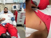 «الهلال الأحمر» تطالب بتوفير الحماية للطواقم الطبية من اعتداءات الاحتلال