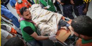 مصابون بقصف لطائرات الاحتلال في محيط مستشفى الإندونيسي شمال قطاع غزة